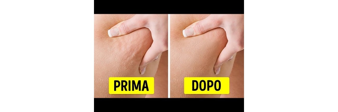 Prima e dopo