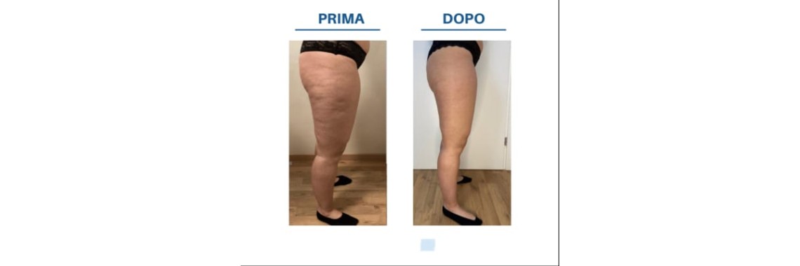 Prima e dopo